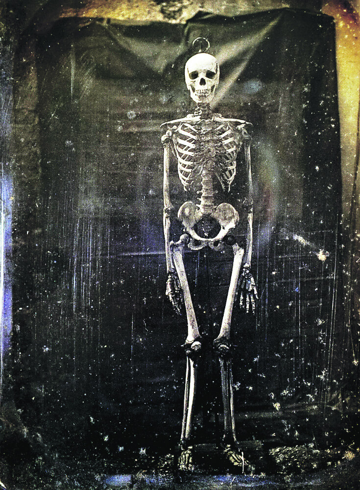 Esqueleto de un negro (1847) ©H. Jacquart/E. Deramond
