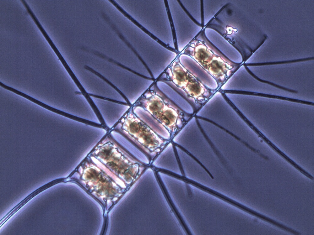 Diatomea Chaetoceros sp. ©José Luis Iriarte