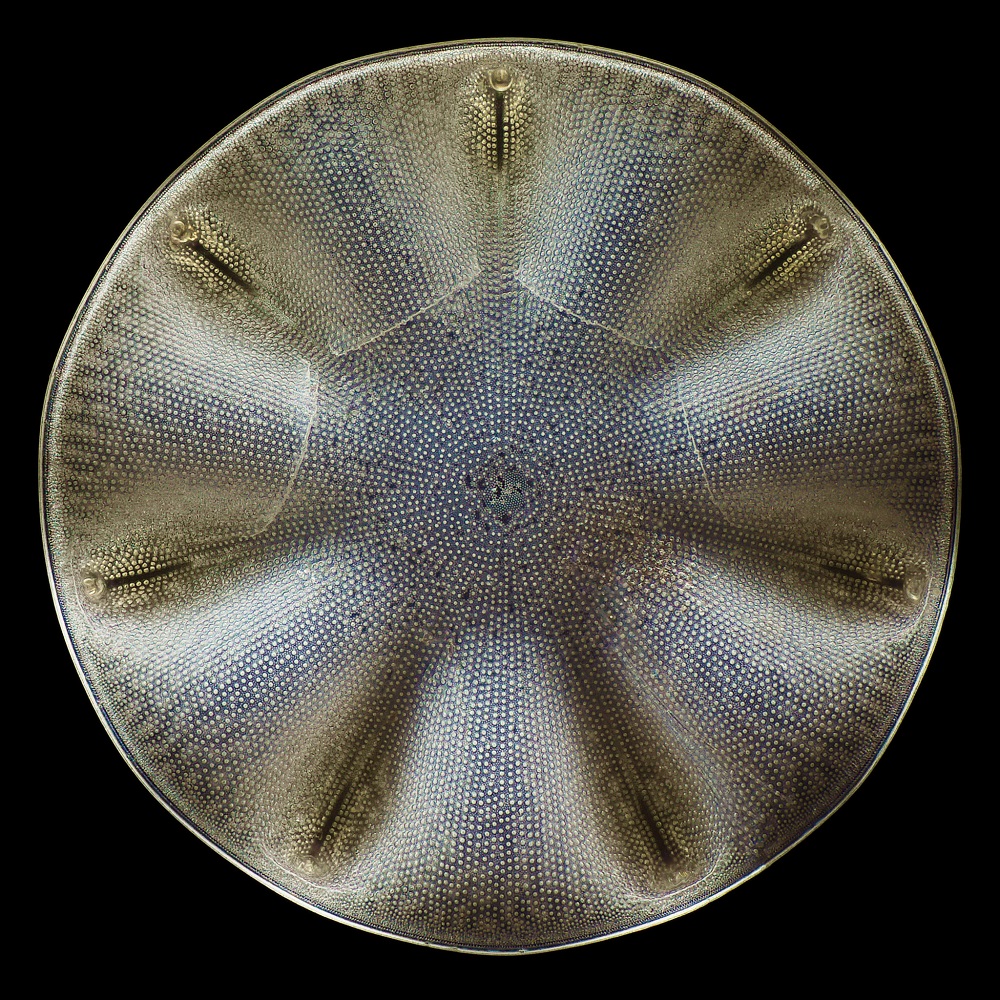 Diatomea Aulacodiscus. ©Michael Landgrebe