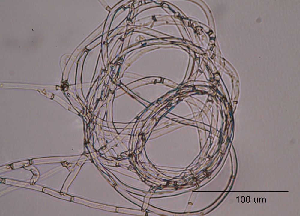 Hongo micorrícico (Ceratobasidium sp.) aislado de Bipinnula volckmannii ©Isabel Mujica
