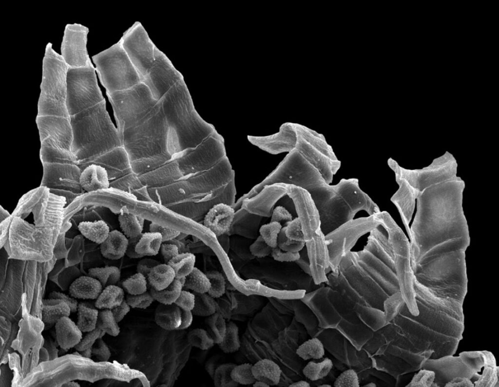 Microfotografía de Orthotrichum camanchacanum. Créditos: fotografías extraídas del estudio. 