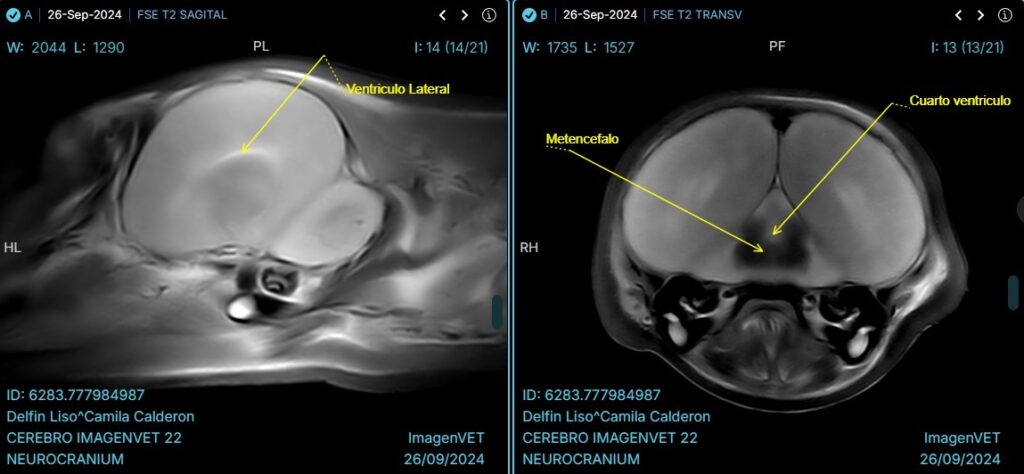 Resonancia magnética Cerebro Delfín