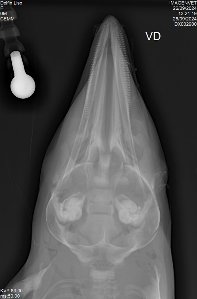 resonancia magnetica delfin 2