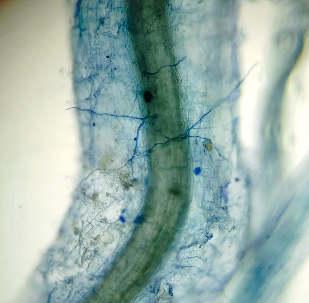 Microrrizas en microscopio. Créditos: Instituto de Ecología y Biodiversidad (IEB).