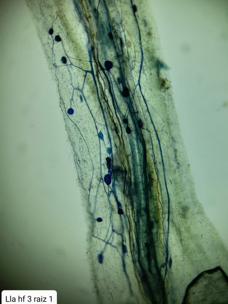 Microrrizas en microscopio. Créditos: Instituto de Ecología y Biodiversidad (IEB).