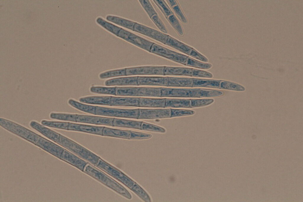 Atractium submersum. Foto por Hugo Madrid.