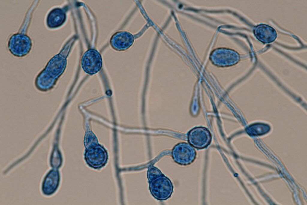 Atractium submersum. Foto por Hugo Madrid.