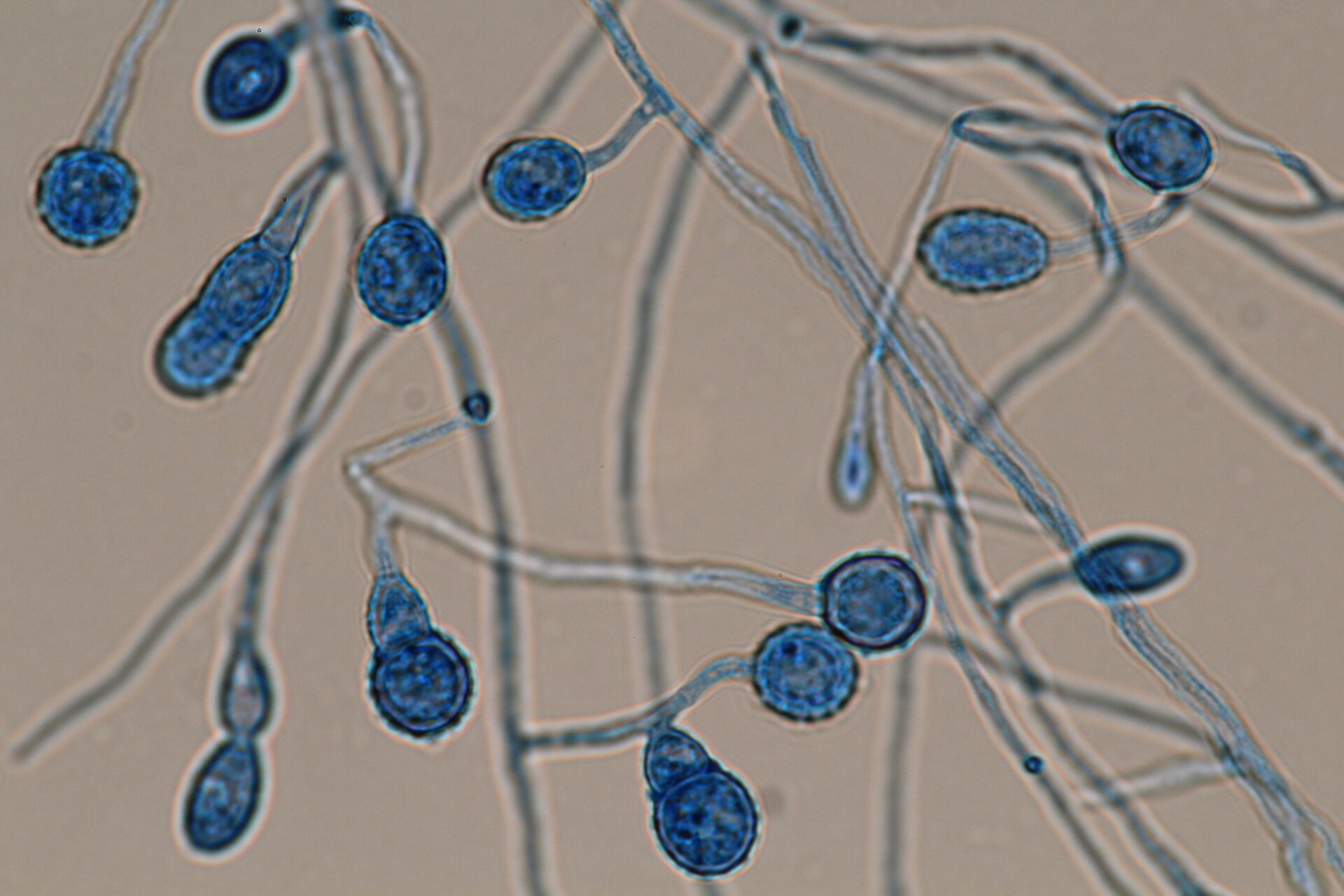 Ocultas a plena vista: Descubren siete nuevas especies de hongos microscópicos en Chile