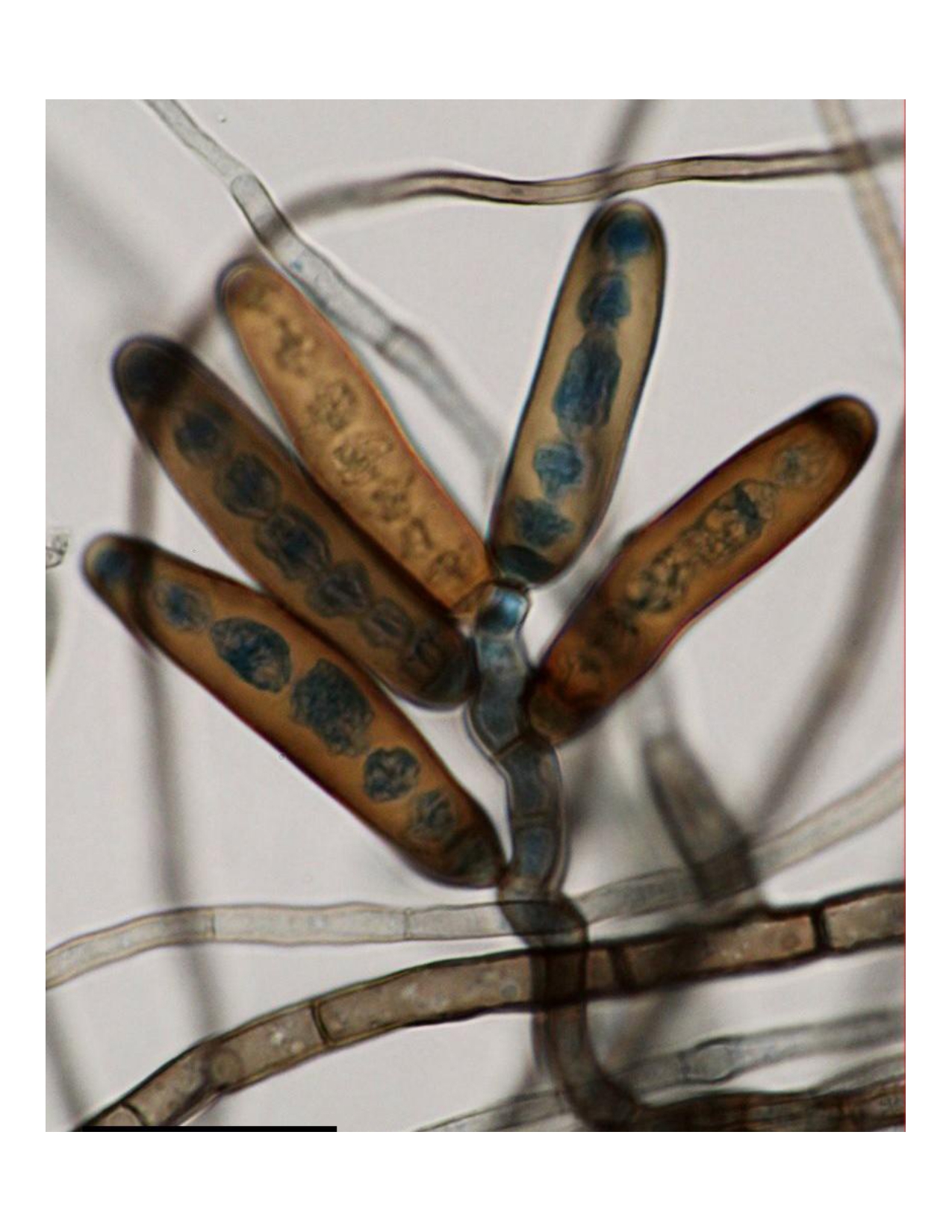 Ocultas a plena vista: Descubren siete nuevas especies de hongos microscópicos en Chile