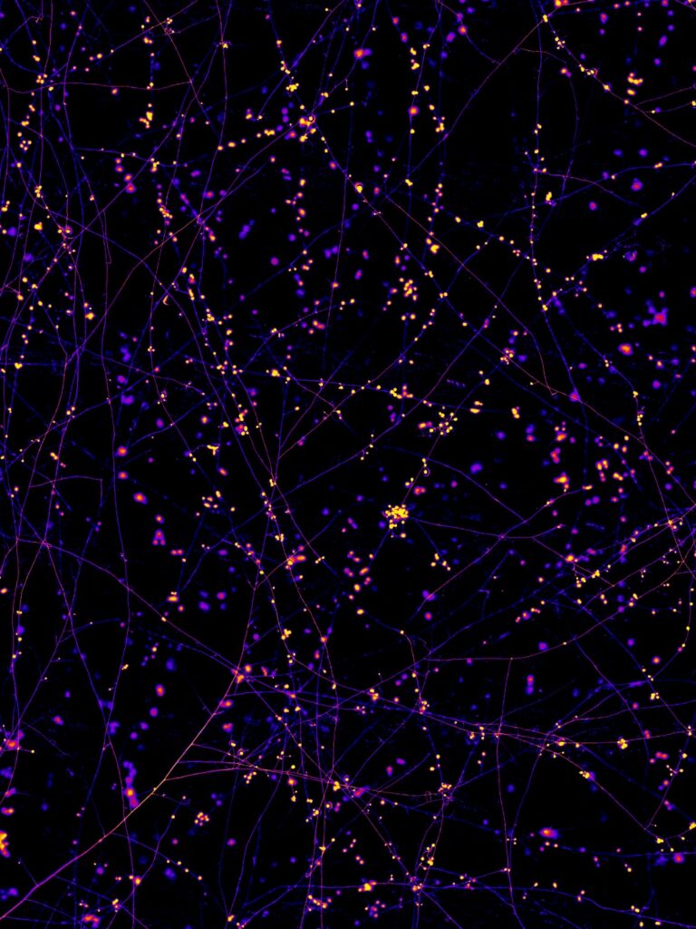 Imagen microscópica de red formada por el hongo micorrízico arbuscular. Créditos: ©Society for the Protection of Underground Networks (SPUN) / Loreto Oyarte Gálvez - VU Amsterdam, AMOLF